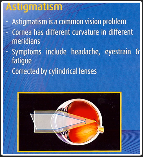  opticals in chennai| opticians in Chennai | contact lens in Chennai | sunglasses in Chennai | eye testing in Chennai | opticals in adyar | cheap and best opticals in chennai